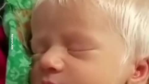Indian woman give birth to white kid😱