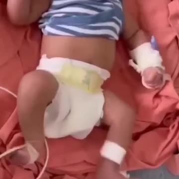 Mother FORCED to take COVID Vaccine in order to to have a needed Cesarean Section