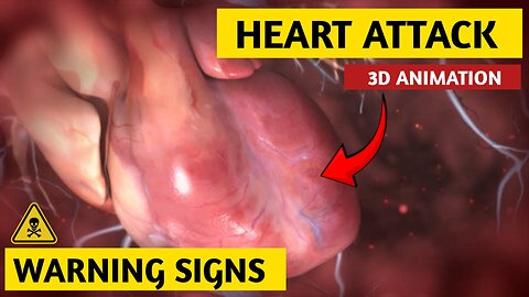 What Happens During HEART Attack 😱