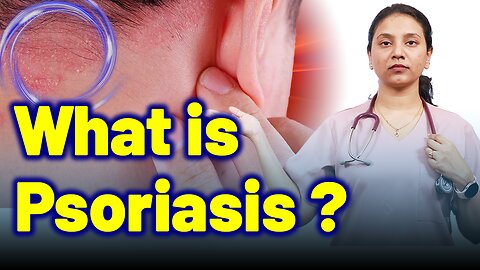 What is Psoriasis ,Chronic Plaque,Erythrodermic,Guttate,Pustular ? Treatment and cure| Homeopathy