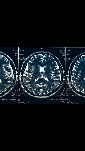 Patent Nr. 3393279, 1968.