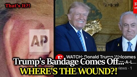 BIG REVEAL: Trump's Bandage Comes Off Showing... Minor Discoloration? Can The Gaslighting Stop Now?
