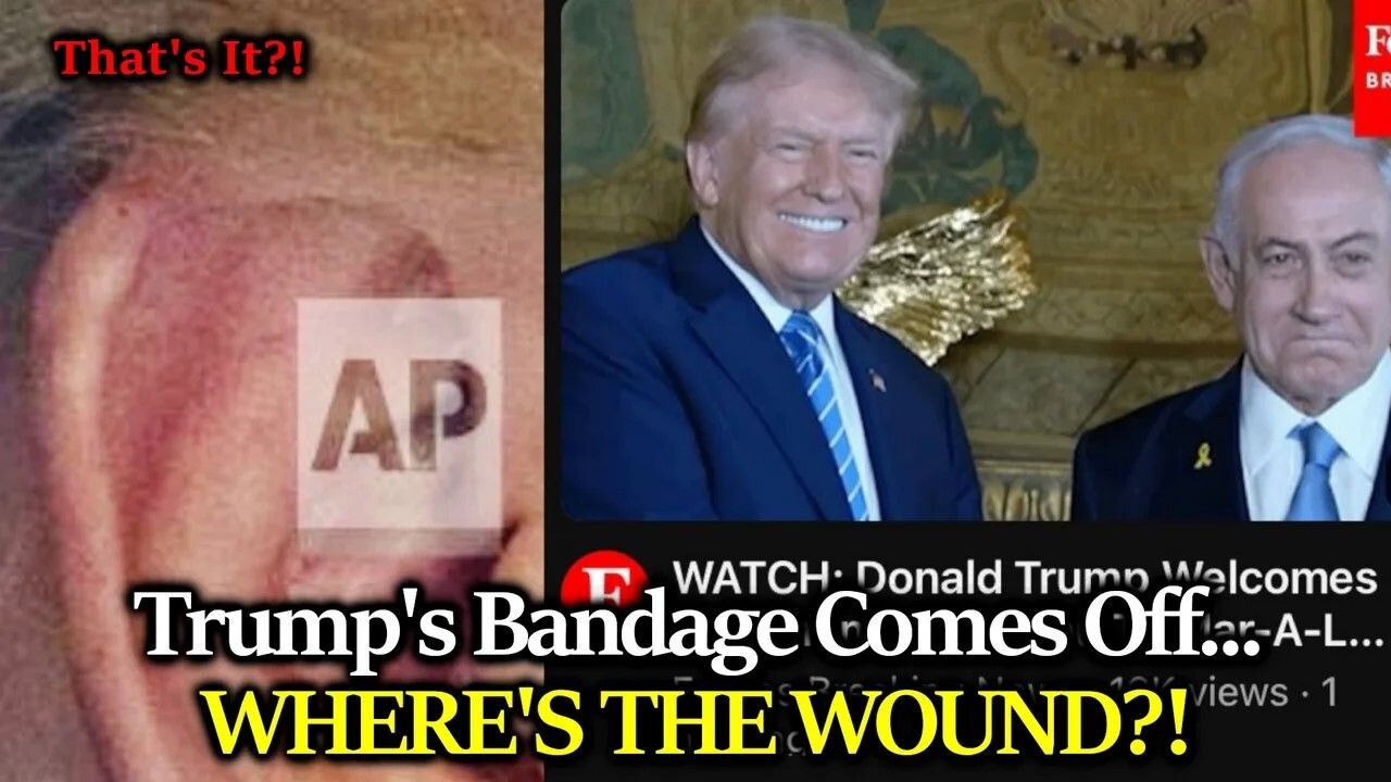 BIG REVEAL: Trump's Bandage Comes Off Showing... Minor Discoloration? Can The Gaslighting Stop Now?