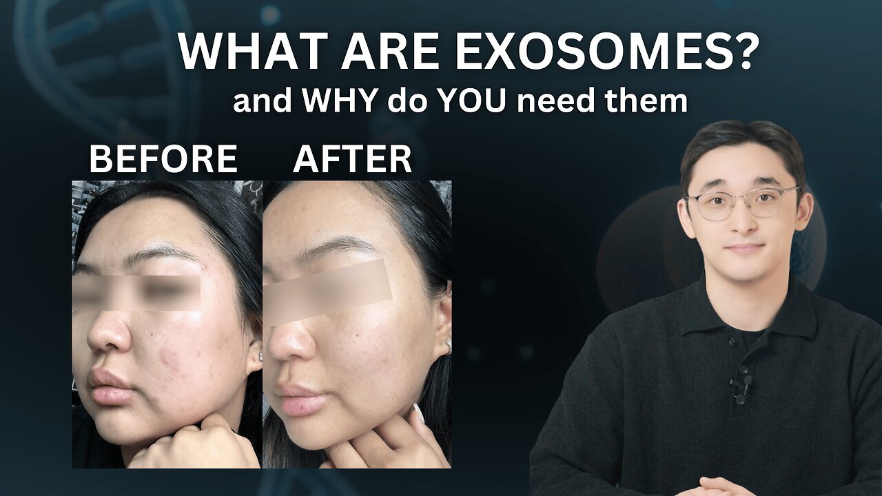 What are exosomes? // Exosomes for skincare | Bacterial, Plant, Human Exosomes