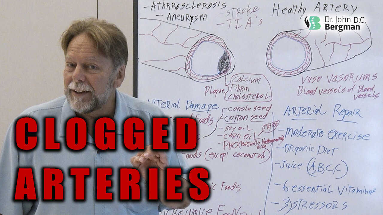 Clogged Arteries π©Έπ«· π
