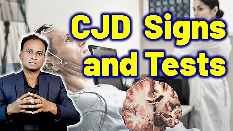 Tests for CJD, Signs & Symptoms of CJD, Creutzfeldt Jakob Disease, Prion Disease, CWD| Neurology