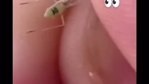 GMO Mosquito