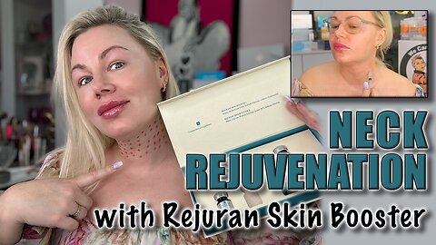 Neck Rejuvination with Rejuran Skin Booster, AceCosm.com and Code Jessica10 Saves you Money