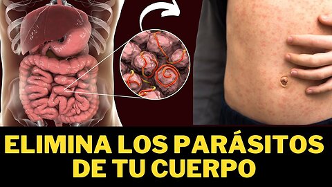 ¡REVELÓ! PARÁSITOS EN EL INTESTINO SÍNTOMAS DE ALARMA ELIMINA PARÁSITOS RÁPIDAMENTE