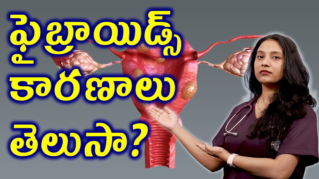 ఫైబ్రాయిడ్స్ కి కారణాలు తెలుసా? Risk factors and Causes for Fibroids, leiomyomas or myomas హోమియోపతి