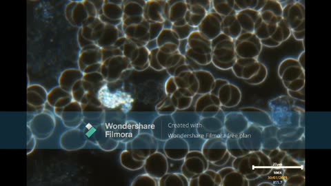Nano Tecnologia en arterias filmada