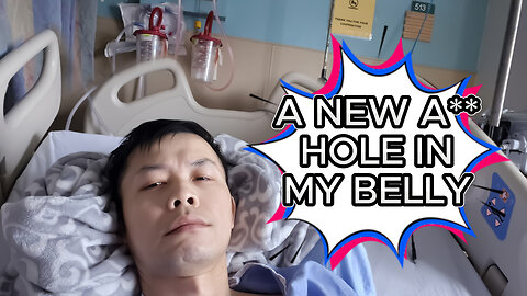 Ep4. | A NEW A** HOLE IN MY BELLY | ileostomy