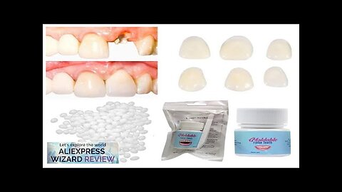 20g Dental Resin Shapeable Teeth Glue Temporary Filling Teeth Repair Makeup Dental Review