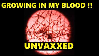 "MY UNVAXED BLOOD HAS FORMED FIBRES !!"