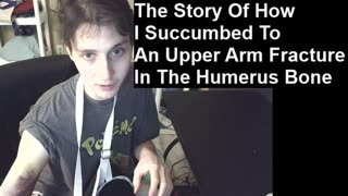 Story Of How I Succumbed To An Upper Arm Fracture In The Humerus Bone (Tripping In A Narrow Walkway)