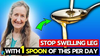 ELIMINATE Poor Blood Circulation In Legs NATURALLY With 1 Spoon Of This OIL Per Day