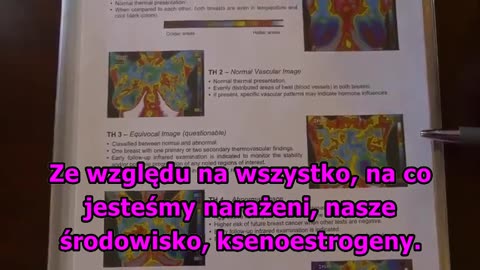 Wojna o Piersi kobiet (większe napisy)