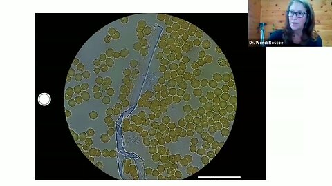 Microscopic Live Blood Analysis - Dr. Wendi Roscoe