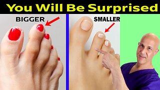 What Your 2nd Toe Says About Your Personality – Dr. Mandell