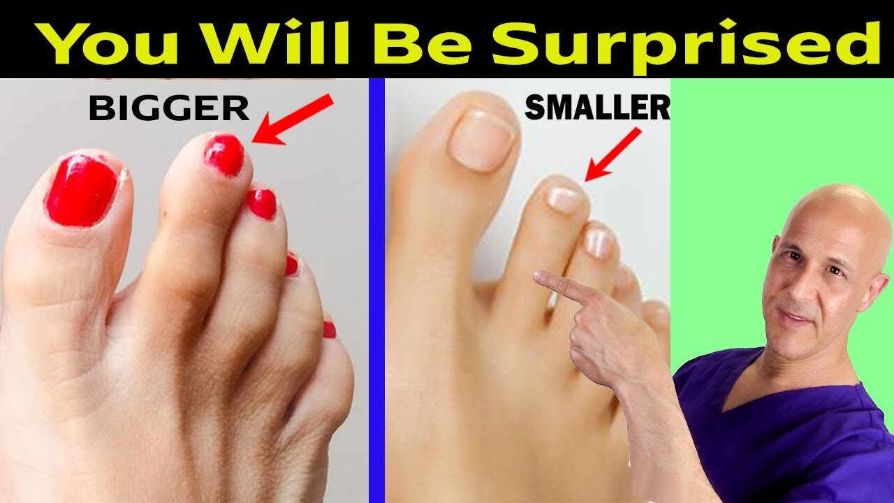 What Your 2nd Toe Says About Your Personality – Dr. Mandell