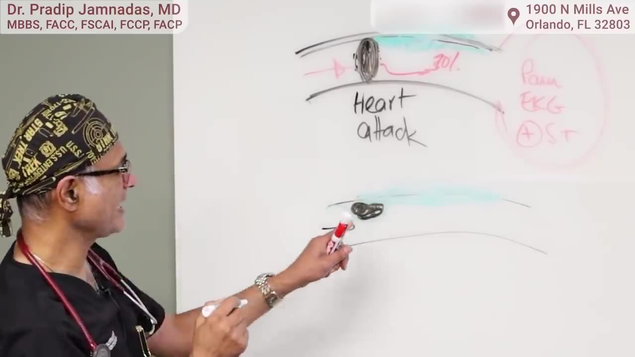 Heart Attacks: What they are and How to Prevent Them