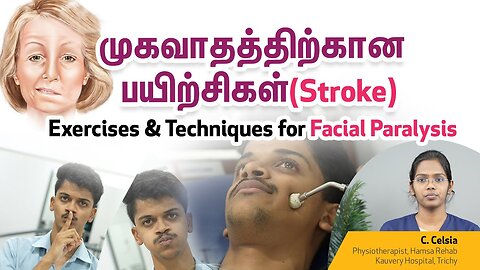 Stroke | Exercises & Techniques for facial paralysis