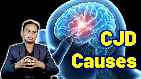 Causes for CJD, Creutzfeldt Jakob Disease, Prion Disease, Mad Cow CWD Treatment Neurology Psychiatry