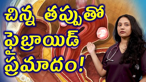 చిన్న తప్పుతో ఫైబ్రాయిడ్స్ ప్రమాదం Best Treatment Option for Fibroids Uterine leiomyomas | హోమియోపతి