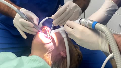 GETTING THREE LARGE MOLARS REPAIRED UNDER GAS || MY VISIT TO THE DENTIST ||