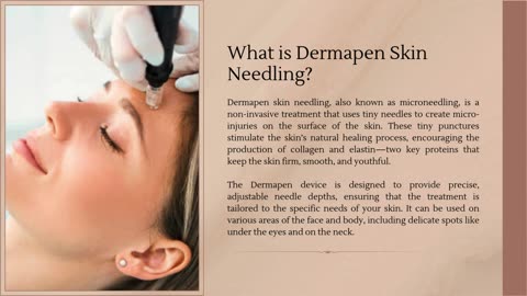 How Dermapen Skin Needling Can Transform Your Complexion