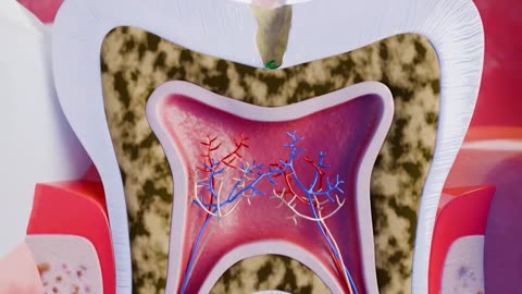 How a teeth abscess develops