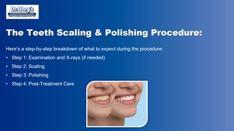 A Detailed Guide to Teeth Scaling & Polishing: Importance, Procedure & Benefits