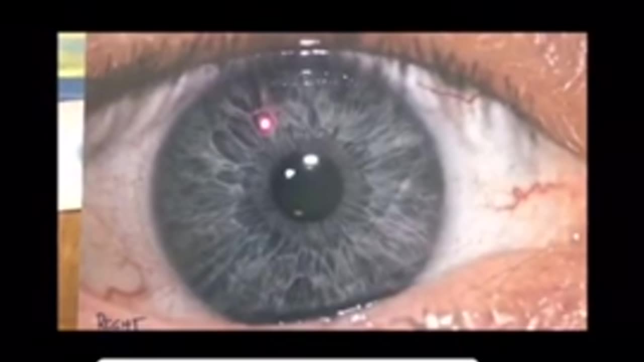 Your eyes are the window to your health