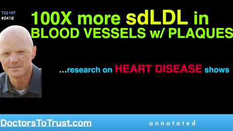 BEN BIKMAN | 100X more sdLDL in BLOOD VESSELS w/ PLAQUES …research on HEART DISEASE shows