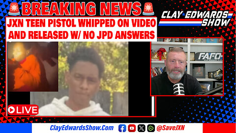 JACKSON, MISSISSIPPI BLACK TEEN ABDUCTED, PISTOL WHIPPED ON VIDEO AND RELEASED W/ NO OTHER DETAILS