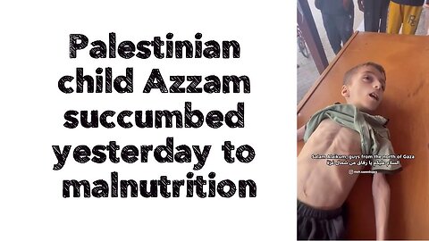 Palestinian child Azzam succumbed yesterday to malnutrition