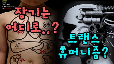 적출된 장기는 어디로 가는 걸까? 트랜스 휴머니즘과 관련 있는 걸까?