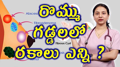 రొమ్ము గడ్డలలో రకాలు ఎన్ని? Types of Fibroadenoma or Breast Mouse Homeopathy Treatment హోమియోపతి