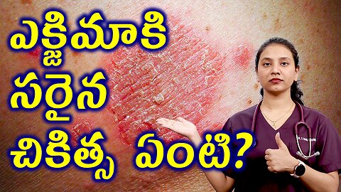 ఎక్జిమా కి సరైన చికిత్స ఏంటి? Advantages of Homeopathy in Treating Eczema Cure Medicine | హోమియోపతి