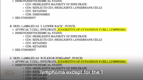 MODERNA COVID INJECTION–TRIAL PARTICIPANT