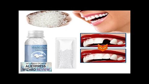 Resin Tooth Repair Glue Shapeable Teeth Gaps Filling Solid Glue Temporary Teeth Review