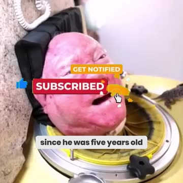 Trapped in an Iron Lung for 73 Years – Paul’s Unbelievable Story