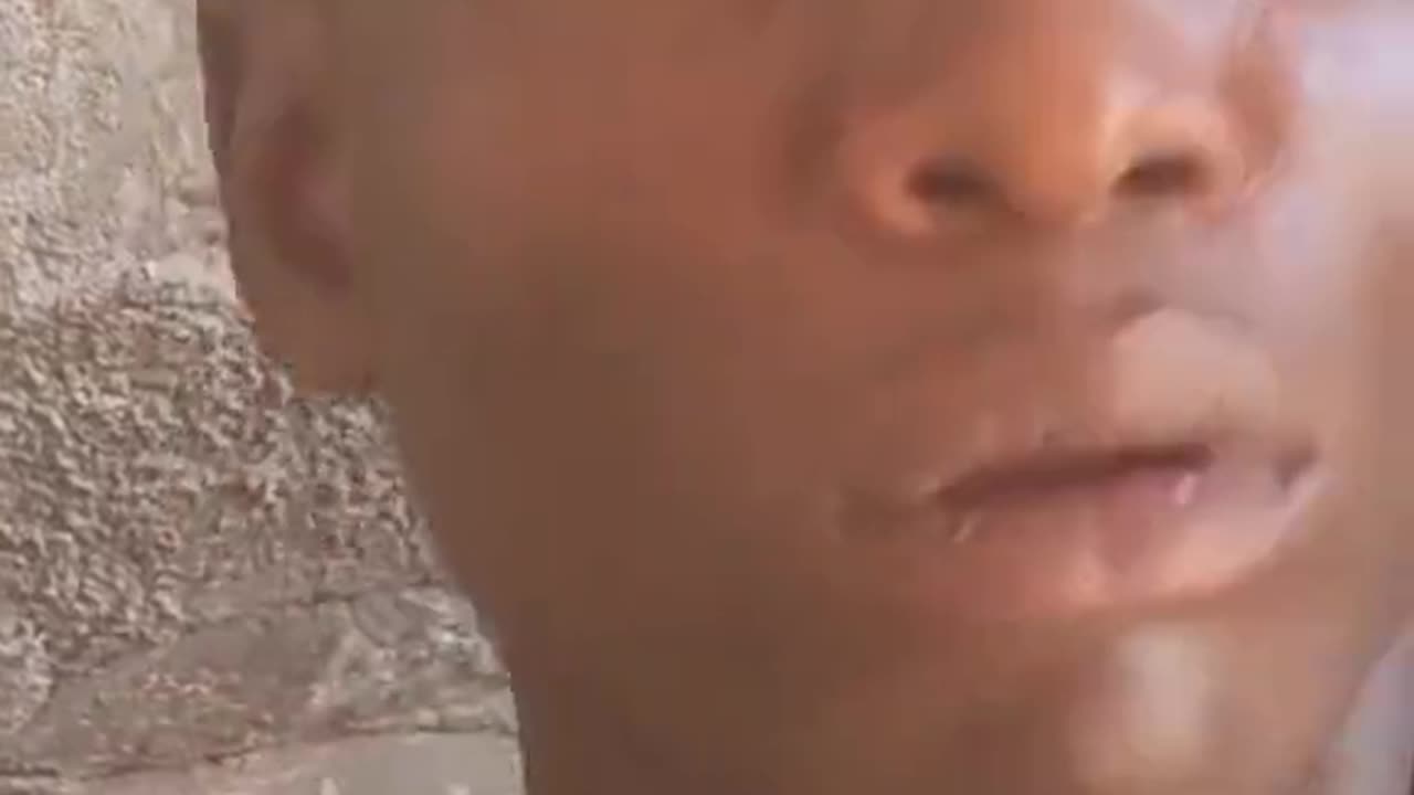 Eye drop#funny🤣#vrliral#clips#hahahaha🤣🤣🤣