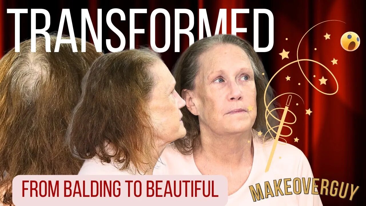 I'm Losing My Hair! Watch My Incredible Transformation!