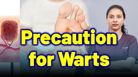 Precautions of Warts | Treatment Cure Relief Medicine | Skin Hair Nail | Homeopathy