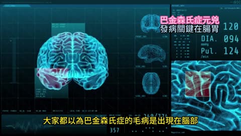 巴金森氏症元兇 發病關鍵在腸胃