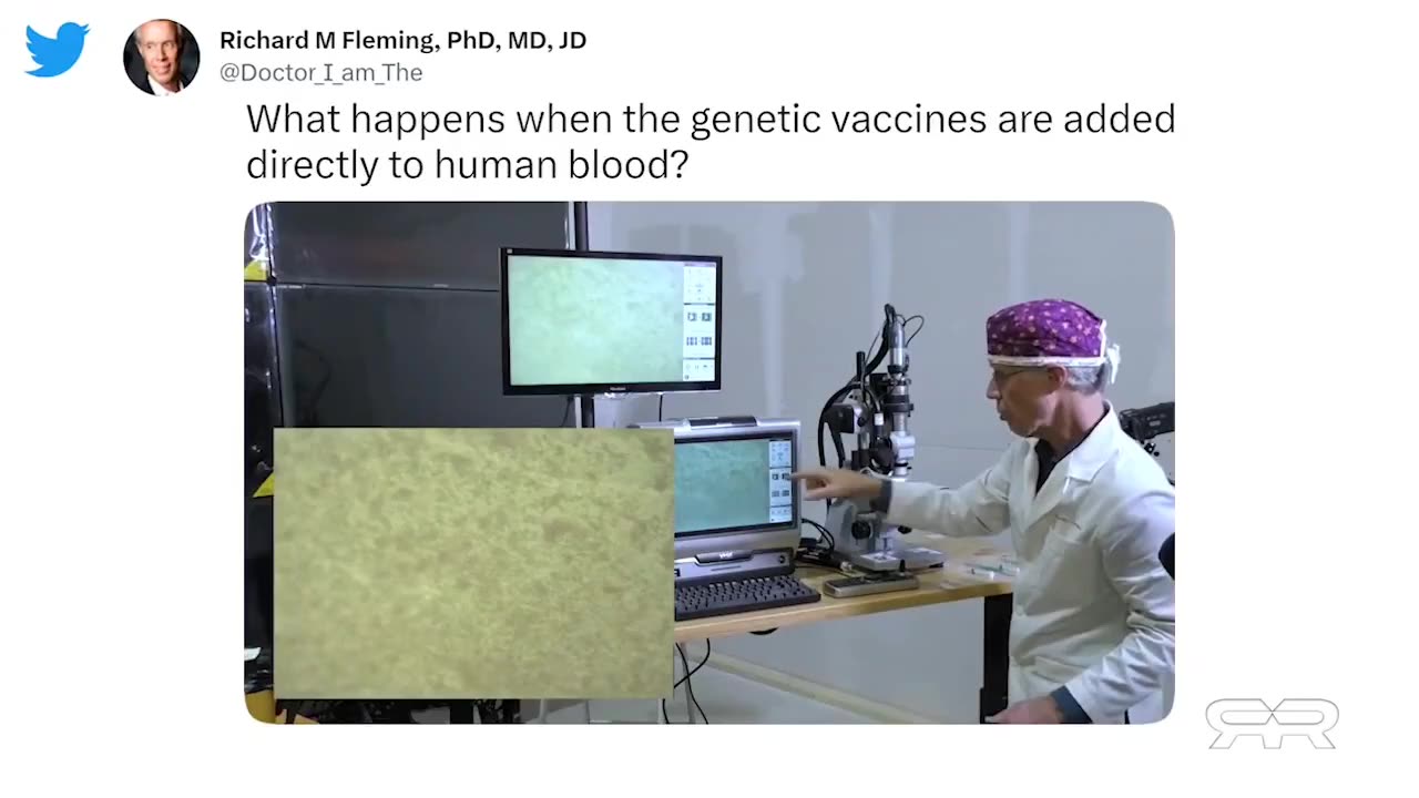 Clotting Exposed