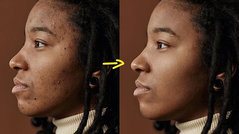 How to Effortlessly Remove Pimples & Blemishes in Photoshop | Quick & Easy Photo Editing Tutorial"