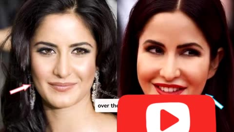 **"Bollywood Actresses and Their Transformative Journeys with Plastic Surgery"**