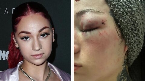 Bhad Bhabie's Baby Daddy Beat Her Up